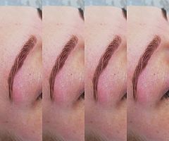 Beauty treatments