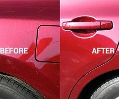 DENT REMOVAL