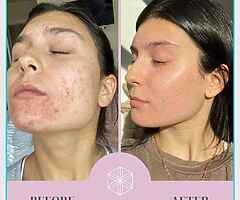 Pm me for more information