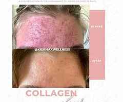 Pm me for more information