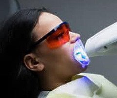 Teethwhitening - Image 3/5
