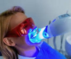Teethwhitening - Image 5/5